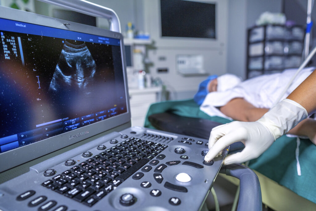 What Black Women Need to Know About Ovarian Cancer Clinical Trials