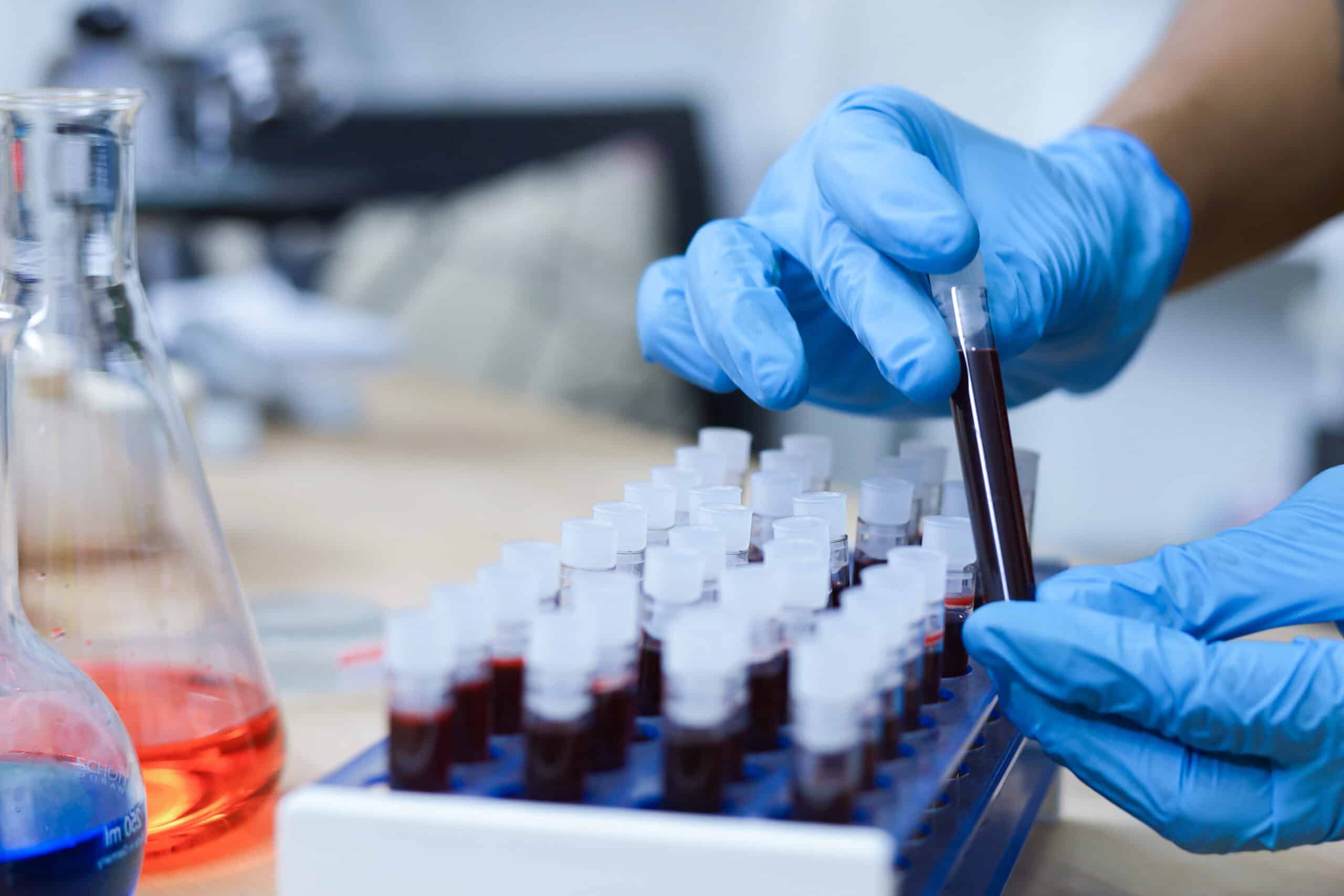 A Black Hematologist Shares How We Can Improve Outcomes For Blood Cancer Patients