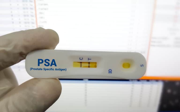 This Clinical Trial Showed Promise in Recurrent Prostate Cancer Patients
