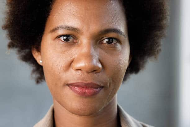 thyroid eye disease