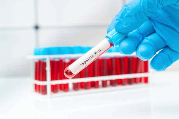syphilis incidence