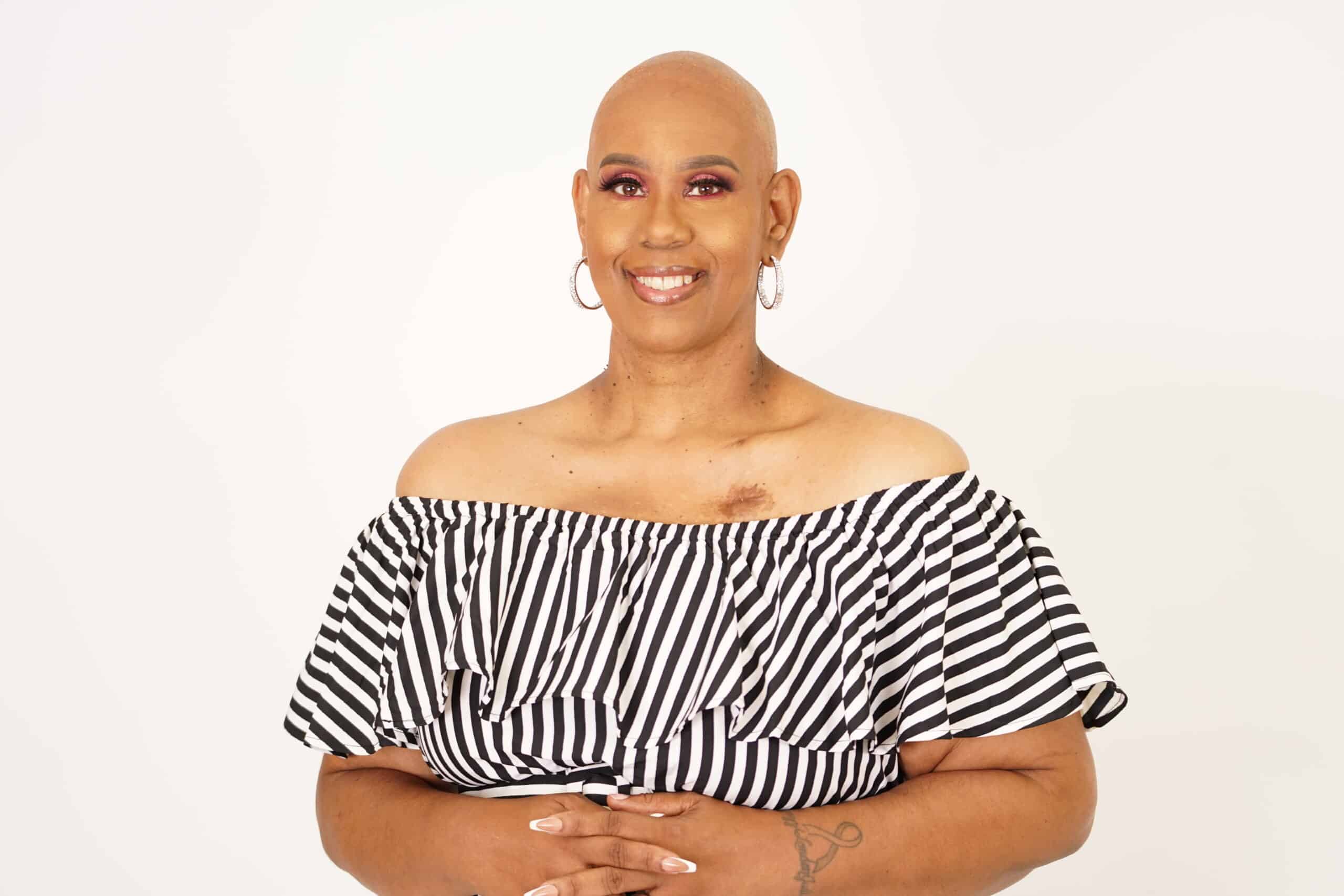 breast cancer