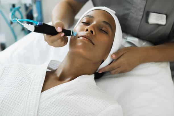 laser hair removal