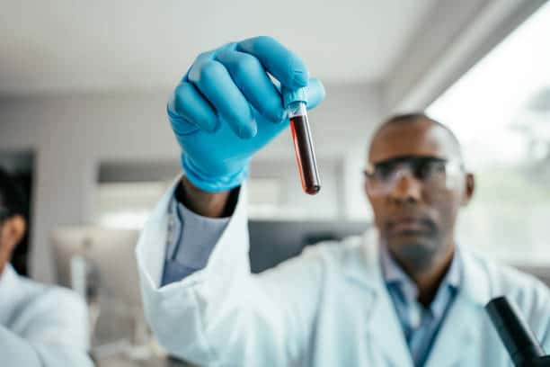 blood test