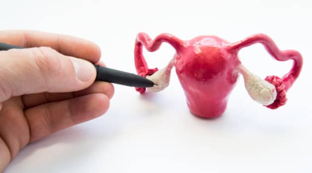 uterine cysts burst