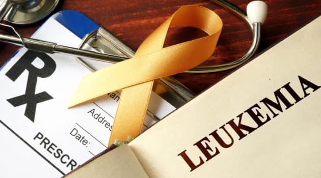 chronic myelogenous leukemia