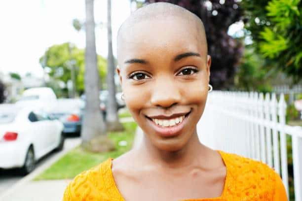 Tried everything for your Alopecia? - Find out how the FPAC clinical trial may help!