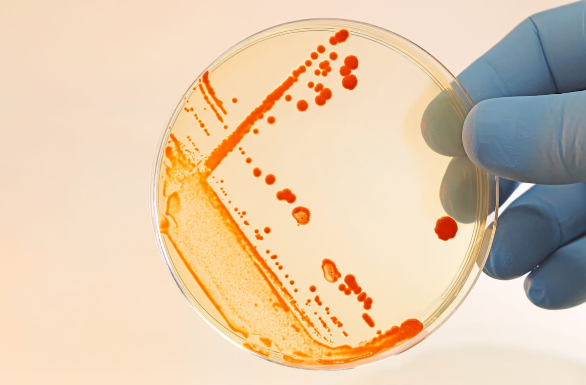4 STDs That Can’t Be Cured