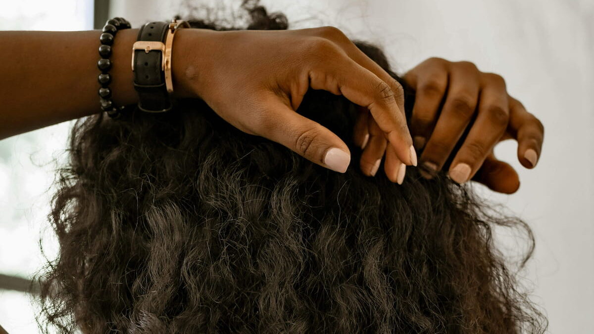 lupus hair loss
